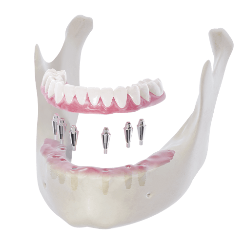 帝歐科技Dioimplant