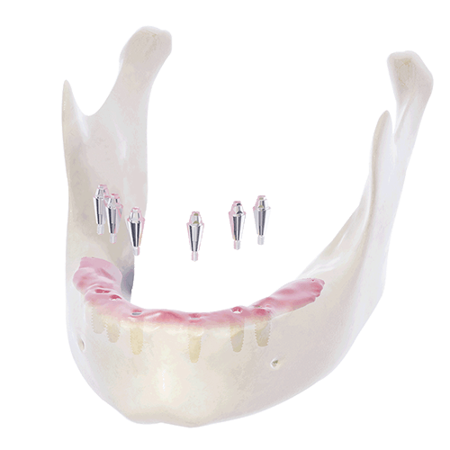 帝歐科技Dioimplant