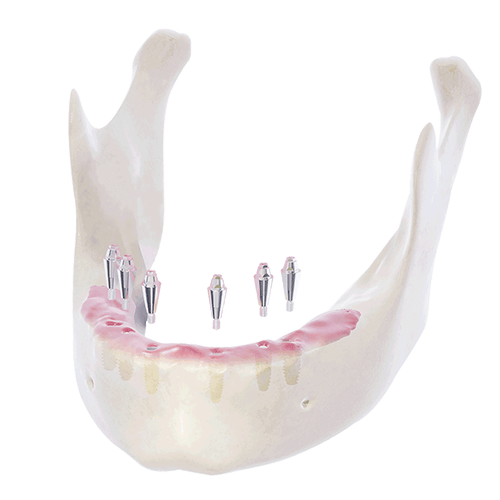 帝歐科技Dioimplant