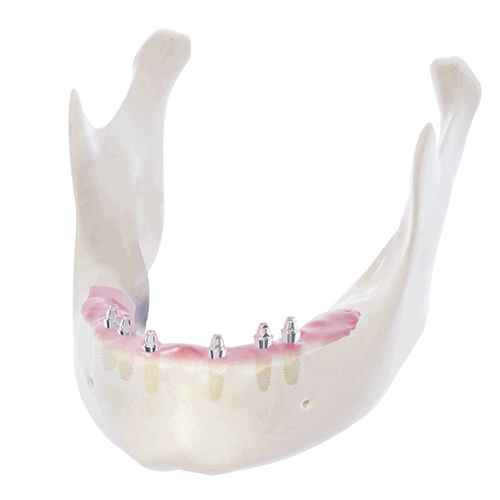 帝歐科技Dioimplant