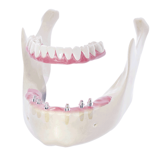 帝歐科技Dioimplant