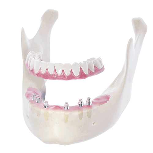 帝歐科技Dioimplant