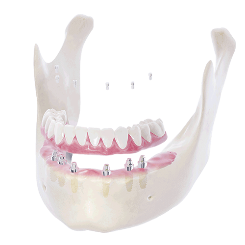 帝歐科技Dioimplant