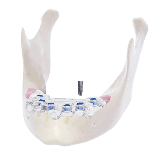 帝歐科技Dioimplant