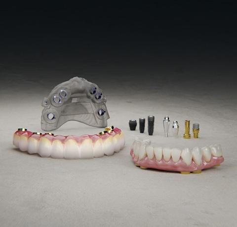 Digital Full Arch Guide System