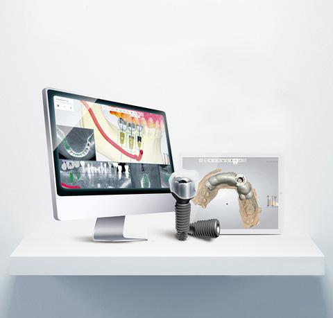 Digital Guided Implant System
