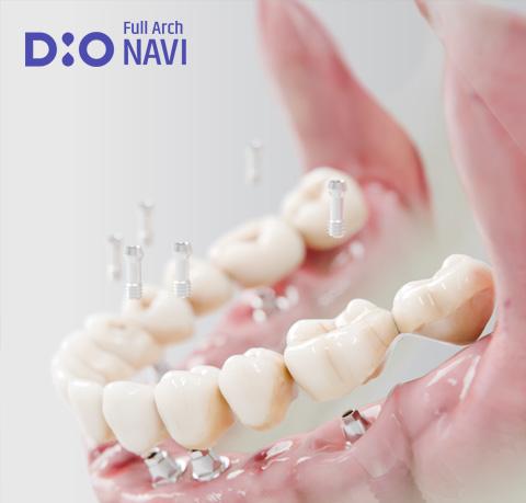 Leaflet-DIO NAVI Full Arch