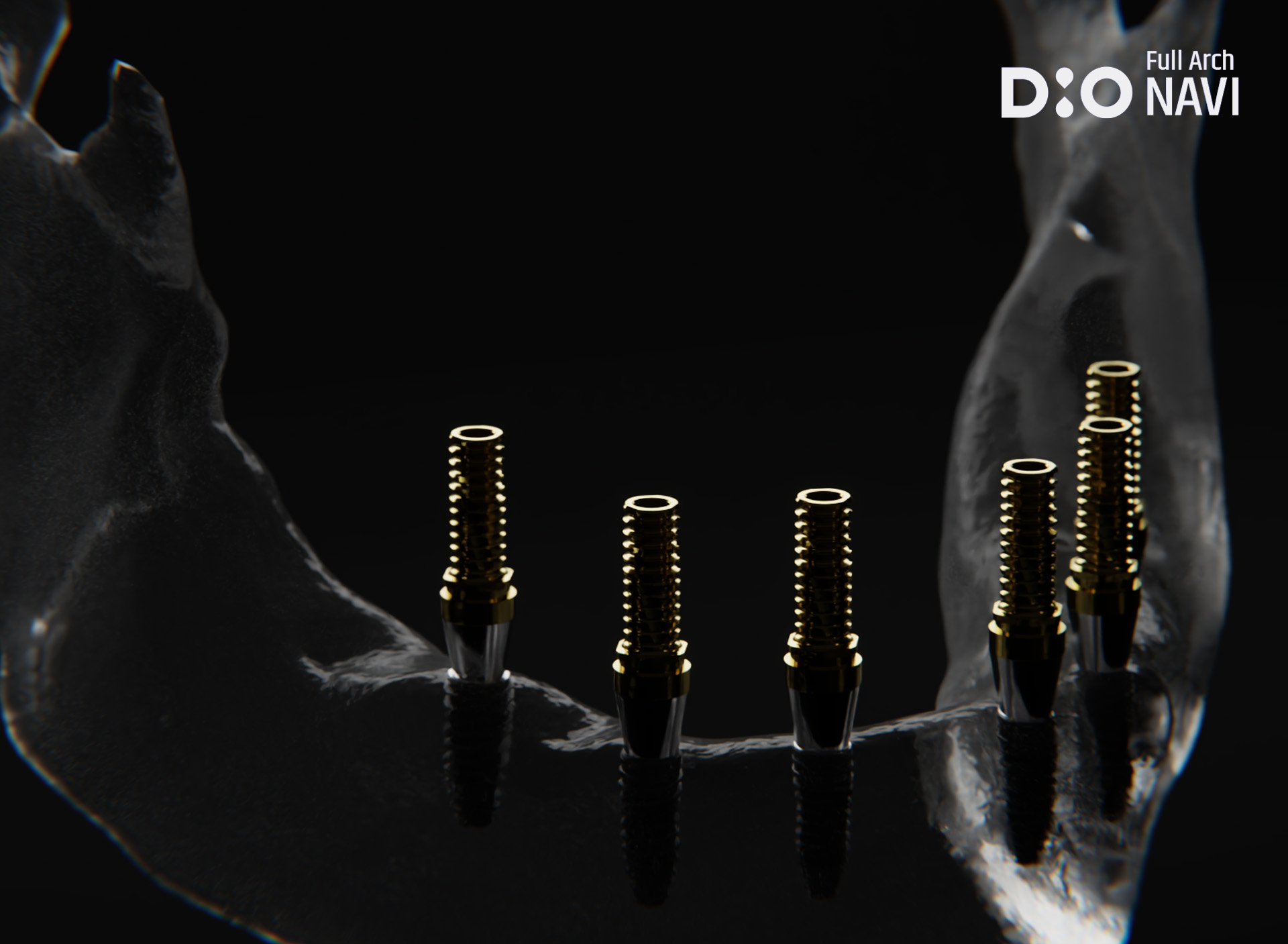 product_dionavi_fullarch_1920x1407_02