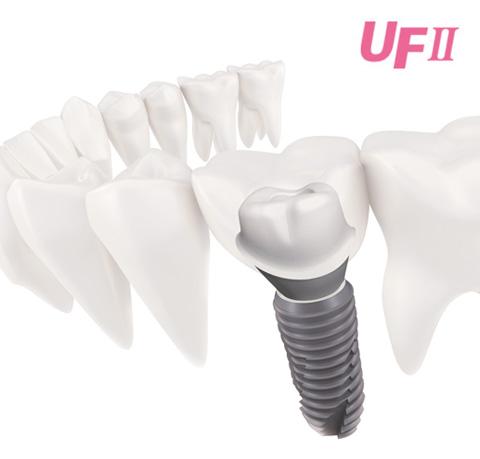 UFII Implant