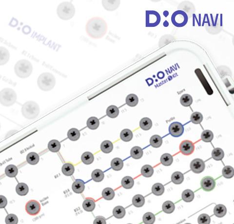 DIO NAVI Kits