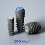 product_implant_ufll_1920x1407_01