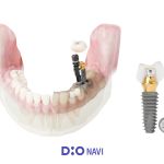 product_dionavi_1920x1407_02