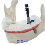 product_dionavi_1920x1407_03