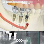 product_dionavi_1920x1407_01