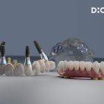 product_dionavi_fullarch_1920x1407_03