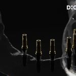 product_dionavi_fullarch_1920x1407_02