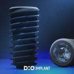 product_implant_unicon_1920x1407_01